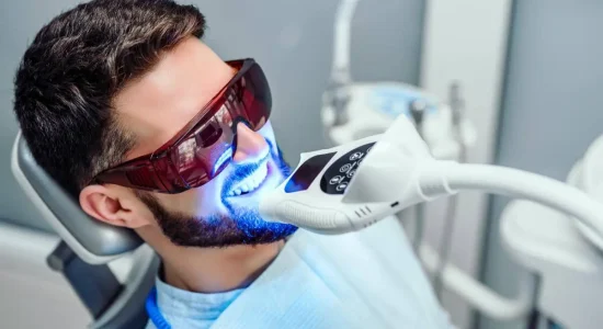 Fastest-Ways-to-Whiten-Teeth