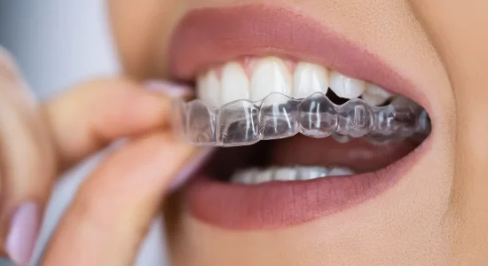 Clear Aligner Dental Night Guard For Teeth
